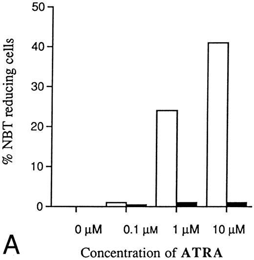 Fig. 7. Dose-dependence of induced differentiation by ATRA or Vit D3 in antisense RB-transfected and mock-transfected U-937 cells. Cells (0.2 × 106 /mL) of (▪) the antisense transfected clone A1 and (□) mock-transfected clone M6 were incubated with ATRA (A) at concentrations ranging from 0 to 10 μmol/L or Vit D3 (B) at concentrations ranging from 0 to 100 nmol/L for 4 days followed by an NBT-reducing test. It was not possible to use higher concentrations of inducer due to toxic effects. Two hundred cells from each clone were counted and the percentage of cells containing reduced NBT was determined. Results shown are from one representative experiment.