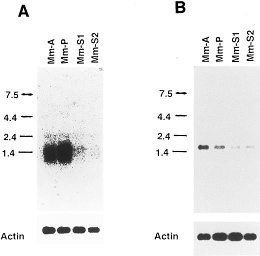 Fig. 2. Northern blots of the mRNA (TRA1) probed with cloned fragment 15T01 and of the mRNA probed with the 15C01 in Mm subline cells. One microgram of poly(A)+RNA was isolated from Mm subline cells and Northern blotted as detailed in the Materials and Methods. The blots were first hybridized with 15T01 (clone 9; A) or 15C01 (clone 24; B; top), stripped, and then hybridized with β-actin (bottom). Size markers (in kilobases) are shown on the left.