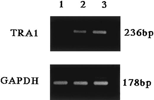Fig. 9. Detection of transfected TRA1 mRNA by RT-PCR. Total RNA (0.2 μg) was isolated from TRA1-transfected and mock-transfected Mm-S1 cells and RT-PCR was performed as detailed in the Materials and Methods. In this condition, transfected TRA1 mRNA and GAPDH mRNA (control) were detected as 236-bp and 178-bp bands, respectively. Lane 1, Mm-S1/neo clone 6 cells; lane 2, Mm-S1/TRA1 clone 24 cells; lane 3, Mm-S1/TRA1 clone 24 cells recovered from ascites of Mm-S1/TRA1 clone 24-injected mouse.