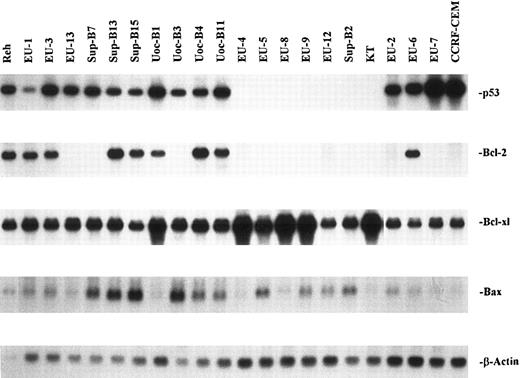 Fig. 1. Northern blot analysis of p53, Bcl-2, Bcl-xl, and Bax mRNA from 22 ALL cell lines. Total RNA was extracted with the GITC-cesium chloride centrifugation method. Total RNA (10 μg per lane) was electrophoresed on a 1% agarose/6% formaldehyde gel. The p53, Bcl-2, Bcl-xl, and Bax probes were prepared by 32P randomized labeling using cDNAs. Hybridization and wash were performed as described in the Materials and Methods. Membranes were rehybridized with a β-actin probe as a control for equal RNA loading and RNA integrity.