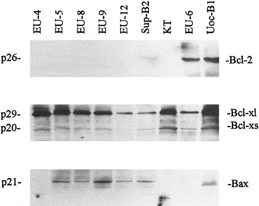 Fig. 2. Western blot assay of Bcl-2, Bcl-xl, and Bax protein expression from representative ALL cell lines (EU-4 → KT, p53-null lines; EU-6, mutant p53+ line; UoC-B1, wt-p53+ line). Protein (20 μg) from cell lysates was electrophoresed in SDS-PAGE gels, transferred to nitrocellulose, and probed with anti-Bcl-2, anti-Bcl-x, and anti-Bax as described in the Materials and Methods. Anti-Bcl-x antibody recognizes both Bcl-xl and Bcl-xs forms.
