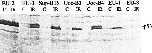Fig. 3. Western blot showing expression and accumulation of p53 protein in ALL cell lines. Protein was harvested from irradiated cells (18 hours post-IR) and from untreated control cells (C). Blots were analyzed with an anti-p53 antibody (Ab2; Oncogene Science) that recognizes both wt and mutant p53. p53 phenotypes: mutant-p53+, EU-2; wt-p53+, EU-3, Sup-B15, UoC-B3, UoC-B4, and EU-1; and p53-null, EU-8.