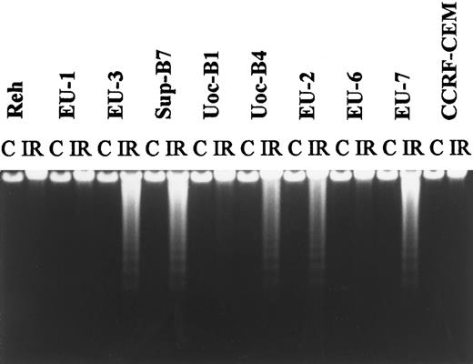 Fig. 4. A representative agarose-gel electrophoresis pattern obtained with DNA extracted from ALL lines. Cells were incubated for 5 hours after exposure to 10 Gy IR; untreated cells served as a control (C).