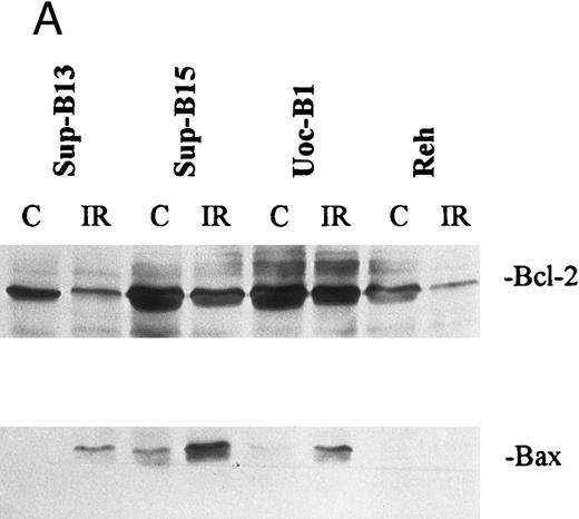 Fig. 5. Regulation of Bcl-2 and Bax in wt-p53+ ALL lines either sensitive (Sup-B13 and Sup-B15) or resistant (UoC-B1 and Reh) to IR (10 Gy). (A) shows Western blot analysis of Bcl-2 and Bax protein that was extracted either pre-IR (C) or at 7 hours post-IR (IR). Densitometric scan of bands in (A) shows relative levels of protein post-IR compared with pre-IR (B).
