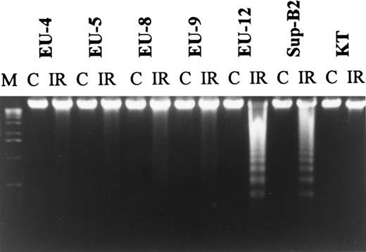 Fig. 7. Agarose gel electrophoresis of DNA from 7 wt-p53−/Bcl-2− ALL lines. DNA fragmentation was not observed in lines EU-4, EU-5, EU-8, EU-9, and KT with Bcl-xl overexpression after treatment with IR.