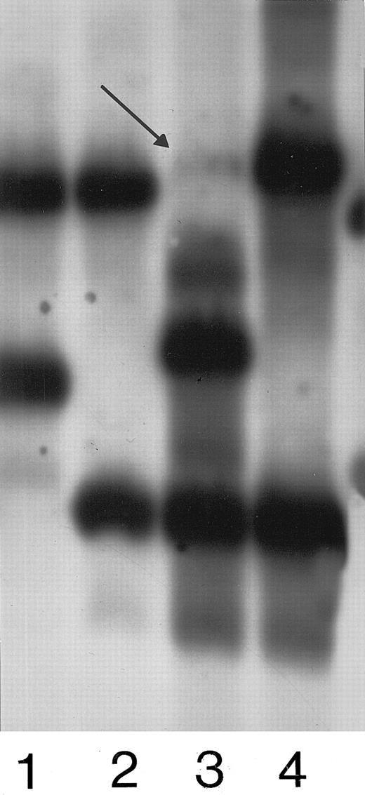 Fig. 1. Lane 1 shows a noncontaminated cord examined with ApoB. Lane 2 shows the respective mother. Lane 3 reports a contaminated cord. Lane 4 shows the mother. The arrow indicates the band due to maternal DNA contamination.
