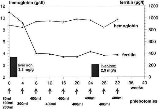 Fig. 1. Hb and serum ferritin concentrations during phlebotomy in the patient suffering from CDA II. Liver iron concentration (per gram wet weight) as measured by biomagnetometry is given in bars. Stepwise increase of removed blood in weeks 1 through 4 (see text).