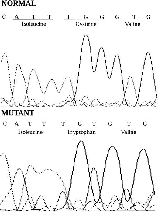 Fig. 1. Chromatograms showing how the 1-bp substitution at nt 549 causes the cysteine amino acid residue at codon 183 to change from cysteine to tryptophan.