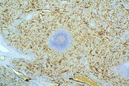 Fig. 3. Immunohistochemistry of spleen using the anti-Duffy MoAb, anti-Fy6. Analysis was done on both freshly obtained and archival specimens of spleen. Anti-Fy6 reacts with specialized endothelial cells (littoral cells) lining the sinusoids in the red pulp. Endothelial cells lining arterioles, venules, arteries, and veins did not stain with anti-Fy6. Similar staining was observed with endothelial cells of postcapillary venules in every organ examined thus far. Immunohistochemical staining of endothelial cells in tissue obtained from Duffy-negative individuals (by RBC typing) was identical to that observed in tissue obtained from Duffy-positive individuals. In contrast to the sinusoids of the spleen, endothelial cells lining hepatic sinusoids did not stain.