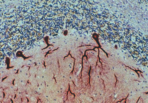 Fig. 6. Purkinje cells of the cerebellum express the DARC. Immunohistochemical staining of archival specimens of human cerebellum with the anti-DARC MoAb, anti-Fy6, showed high-level expression of DARC by Purkinje neurons. This staining was inhibited by a recombinant fusion protein in which the amino terminal extracellular domain of DARC was expressed in continuous translational frame with glutathione-S-transferase. Cross-linking experiments with 125I-labeled MGSA and immunoblots with anti-Fy6 showed that MGSA and anti-Fy6 react with a protein component of cerebellar membranes with the same size and appearance on SDS-PAGE as RBC and endothelial cell DARC (data not shown).