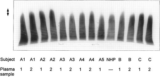 Fig. 1. Multimeric analysis of plasma vWF in SDS-1% agarose gel. Equal amounts of vWF:Ag (0.0025 U vWF:Ag/lane) from four patients with chronic relapsing TTP (A1, A2, B, and C), from asymptomatic family members (A3, A4, and A5) and of pooled NHP were applied on top of the gel and the vWF multimers were detected by immunostaining. The double-sided arrow (↕) denotes the unusually large vWF multimers. Plasma samples from each patient were obtained on two separate occasions at dates given in Table 1.