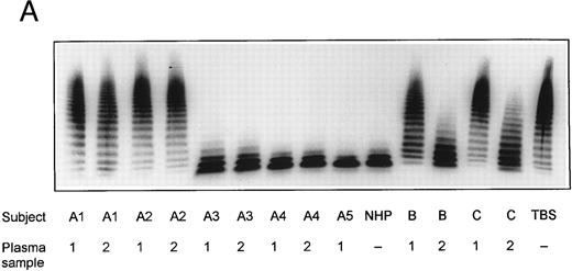 Fig. 2. vWF-cleaving protease activity in plasma from patients with chronic relapsing TTP, from asymptomatic family members and in NHP. Each plasma was diluted 1:20 with TBS/1 mmol/L Pefabloc before incubation with purified vWF. The SDS-1.4% agarose gel (A) shows multimeric patterns of the vWF substrate after incubation with either diluted plasma samples or with Tris-buffered saline (TBS). Analysis of the disulfide-reduced incubation mixtures was performed by SDS-polyacrylamide gel electrophoresis (B). The arrows indicate positions of the intact vWF subunit (250 kD) and of its proteolytic fragments (170 kD and 140 kD).