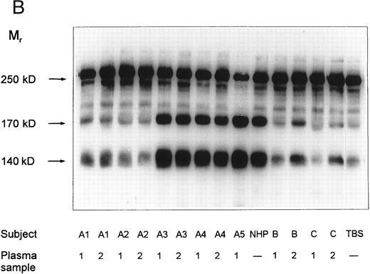 Fig. 2. vWF-cleaving protease activity in plasma from patients with chronic relapsing TTP, from asymptomatic family members and in NHP. Each plasma was diluted 1:20 with TBS/1 mmol/L Pefabloc before incubation with purified vWF. The SDS-1.4% agarose gel (A) shows multimeric patterns of the vWF substrate after incubation with either diluted plasma samples or with Tris-buffered saline (TBS). Analysis of the disulfide-reduced incubation mixtures was performed by SDS-polyacrylamide gel electrophoresis (B). The arrows indicate positions of the intact vWF subunit (250 kD) and of its proteolytic fragments (170 kD and 140 kD).