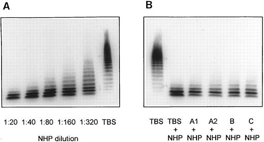 Fig. 3. Screening for inhibitors against vWF-cleaving protease in patient plasmas. NHP dilutions 1:20, 1:40, 1:80, 1:160, and 1:320 were used for calibration of the vWF-cleaving protease assay (A). Mixtures of equal volumes of NHP and patient plasmas were diluted with 9 vol of TBS/1 mmol/L Pefabloc and contained, accordingly, a 1:20 dilution each of normal and patient plasma (B).