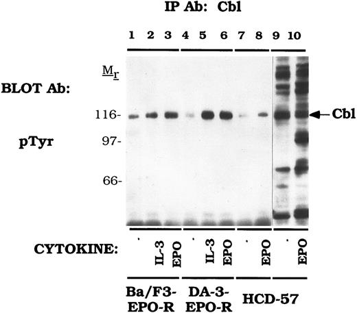 Fig. 1. EPO and IL-3 activate tyrosine phosphorylation of Cbl. Ba/F3 (lanes 1-3), DA-3-EPO-R (lanes 4-6), and HCD-57 (lanes 7-10) cells were depleted of cytokine for 4 hours and stimulated with no factor (lanes 1, 4, 7, and 9), 50 U of murine IL-3 (lanes 2 and 5) or 50 U/mL of human EPO (lanes 3, 6, 8, and 10) for 15 minutes. Following cell lysis, an immunoprecipitation was performed with an anti-Cbl polyclonal antibody. Lysate controls are shown in lanes 9 and 10. Immune complexes were resolved by SDS-PAGE and blotted to nitrocellulose. The immunoblot was probed with an anti-phosphotyrosine (pTyr) monoclonal antibody 4G10. Molecular mass standards are indicated.