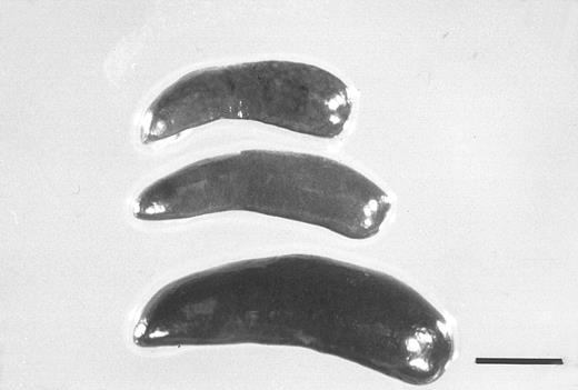Fig. 5. Spleens from a control mouse (top) and from mice treated for 5 days with G-CSF (250 μg/kg) alone (middle), or together with FL (20 μg/kg) (bottom). The bar indicates 5 mm.