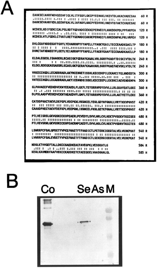 Fig. 2. Characterization of the RSA cDNA. The protein sequence corresponding to the mature, circulating RSA, deduced from the DNA sequence of p(alb)192, is shown in (A), aligned to its human counterpart. R, RSA; H, HSA. Double dots indicate identical, and single dots, similar residues; amino acid numbering is shown at the right. (B) An immunoblot stained with mono-specific anti-RSA antibodies. Lane Se, conditioned media from Cos cells transfected with pSG5-RSA (sense orientation); lane As, equivalent amount of conditioned media from cells transfected with pSG5-ASR (antisense orientation). M, prestained low-molecular-weight range markers (BioRad); Co, positive control (250 ng purified plasma-derived RSA).