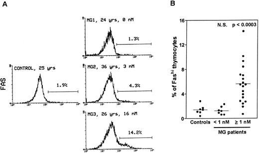 Fig. 1. Comparison of Fas expression in thymocytes from controls and MG patients. Freshly isolated thymocytes were stained with anti-Fas antibody, then with goat-antimouse IgG antibody, and finally with Cy-chrome-labeled streptavidin. Using the Lysis II program, a marker was set to define the proportion of Fashi thymocytes. (A) Representative analysis of one control and three MG thymuses. The percentage of Fashi thymocytes is indicated, as well as age and the anti-AChR antibody titer (nmol/L). Fas expression is clearly increased in patients with positive anti-AChR antibody titers (MG2 and MG3) but not in the patient with a negative titer (MG1). (B) The proportion of Fashi thymocytes was determined in 26 MG patients and 7 control subjects. Two groups of patients (anti-AChR antibody titer < 1 nmol/L and ≥1 nmol/L) are distinguished and compared with controls by using the Mann-Whitney test. The bar represents the mean value. Only the group of patients with positive anti-AChR antibody titers differed from the controls.