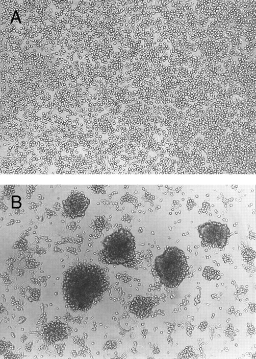 Fig. 1. Homotypic aggregation of cultured human mast cells induced by IL-4. Cultured human mast cells were grown from CB MNCs in the presence of SCF (100 ng/mL) and IL-6 (80 ng/mL) for 10 weeks. Cells were then incubated for 10 days without (A) or with (B) IL-4 (10 ng/mL) in the presence of SCF and IL-6. Half of the media was changed on the fifth day of the culture. This experiment has been repeated five times with similar results.