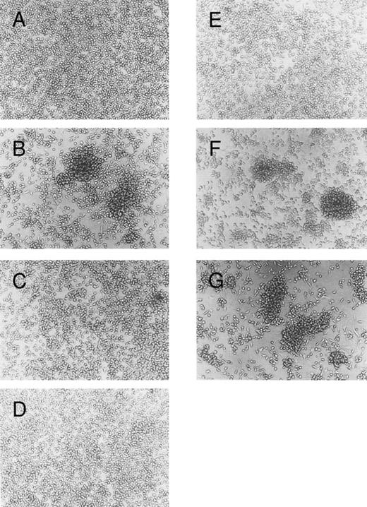 Fig. 4. Blocking of homotypic aggregation with antibodies specific for LFA-1α, LFA-1β, or ICAM-1. Human mast cells were cultured in the presence of SCF (100 ng/mL) and IL-6 (80 ng/mL); (A) without, (B) with IL-4 (10 ng/mL). Mouse MoAbs (20 μg/mL) specific for (C) LFA-1α (TS1/22), (D) LFA-1β (TS1/18), (E) ICAM-1 (RR1/1), (F ) VLA-5 (KH/33), or (G) VLA-4 (SG/73) were added to the culture in the presence of SCF, IL-6, and IL-4. The cells were incubated for 5 days. This experiment has been repeated three times with similar results.