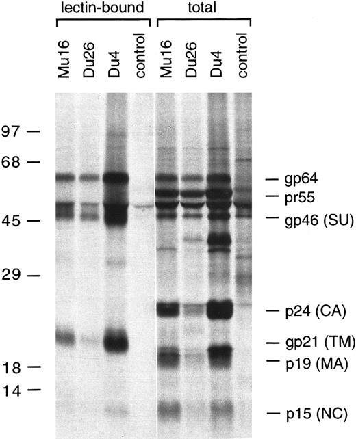 Fig. 4. SDS-PAGE analysis of metabolically labeled HTLV-I proteins immunoprecipitated from the Du4, Du26, and Mu16 clones using a TSP patient serum.