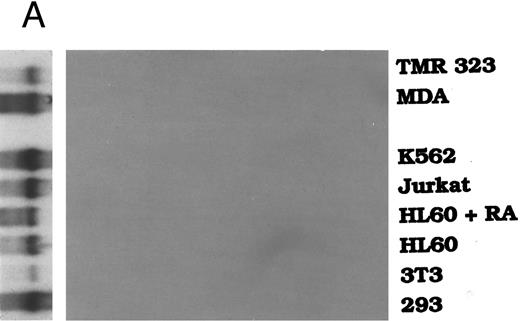 Fig. 2. Northern analysis of the expression of Exodus. (A) Exodus is not expressed in a variety of hematopoietic and nonhematopoietic cell lines in poly A+ Northern analysis. (B) Commercially prepared poly A+ Northern blots of a variety of normal human lymphoid and nonlymphoid tissue. Exodus is preferentially expressed in lymphoid tissue, consistent with the other members of the β-chemokine family. (C) Exodus expression is induced in monocytic and endothelial cells when they are exposed to inflammatory stimuli. PBMC are normal human PBMCs, I-HUVEC are cultured human umbilical vein endothelial cells, and THP-1 are human monocytic leukemia cells. LPS is lipopolysaccharide. The blots in 2A and 2C were rehybridized with actin to control for integrity and loading of RNA. These signals are shown below the Exodus Northerns. The commercially-prepared Northerns were not rehybridized with actin.