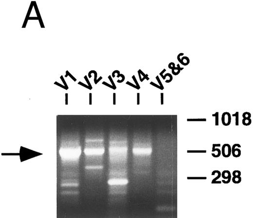 Fig. 1. PCR analysis of rearranged VH genes. Lymphoma DNA was amplified with six different VH leader primers and a consensus JH primer and the resultant products electrophoresed in 1.5% agarose and stained with ethidium bromide as shown in (A). Note the dominant band of the expected size (arrow) generated with the VH1-JH primer combination suggesting the lymphoma is using a VH1 family gene. To assess clonality, the VH PCR products and lymphoma DNA were further amplified with the FW3 and JH primers and the resultant products electrophoresed in 10% acrylamide and stained with ethidium bromide as shown in (B). Observe that the VH1 PCR products give a clonal band that comigrates with the clone in the lymphoma DNA (arrow), while the other PCR products give only polyclonal laders representing different sized V-D-J joints.
