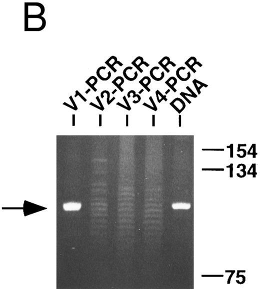 Fig. 1. PCR analysis of rearranged VH genes. Lymphoma DNA was amplified with six different VH leader primers and a consensus JH primer and the resultant products electrophoresed in 1.5% agarose and stained with ethidium bromide as shown in (A). Note the dominant band of the expected size (arrow) generated with the VH1-JH primer combination suggesting the lymphoma is using a VH1 family gene. To assess clonality, the VH PCR products and lymphoma DNA were further amplified with the FW3 and JH primers and the resultant products electrophoresed in 10% acrylamide and stained with ethidium bromide as shown in (B). Observe that the VH1 PCR products give a clonal band that comigrates with the clone in the lymphoma DNA (arrow), while the other PCR products give only polyclonal laders representing different sized V-D-J joints.