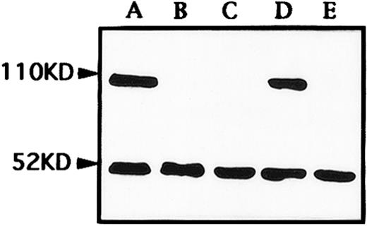 Fig. 6. Western blot analysis of RARα and PML-RARα expression in NB4 cells untreated (A), treated with 1 μmol/L As2O3 for 24 hours (B) and 48 hours (C), and with 0.1 μmol/L As2O3 for 24 hours (D) and 48 hours (E). Both bands of 52 kD and 110 kD represented wild-type RARα and PML-RARα chimeric proteins, respectively.