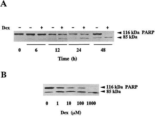 Fig. 1. PARP cleavage in B-CLL cells. (A) Time course of dexamethasone-induced PARP cleavage. B-CLL lymphocytes were incubated with or without 10 μmol/L dexamethasone for the indicated times. (B) Dose response of PARP cleavage. Cells were incubated for 48 hours with various concentrations of dexamethasone as indicated. PARP cleavage was analyzed by Western blot as described in Materials and Methods. The position of the native PARP (116 kD) and the proteolytic fragment (85 kD) is indicated.