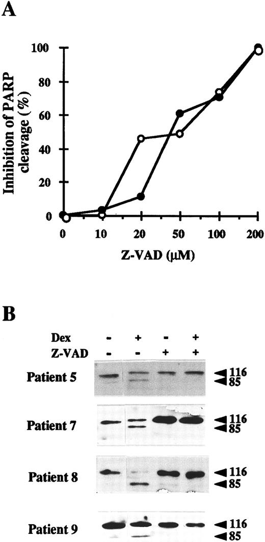 Fig. 4. Effect of the CED-3/ICE–like protease inhibitor Z-VAD.fmk on PARP proteolysis in B-CLL cells. (A) Dose response of the inhibitory effect of Z-VAD.fmk on PARP proteolysis. Cells from patient 6 were incubated without dexamethasone (○) and cells from patient 9 were incubated with 10 μmol/L dexamethasone (•), in the presence of various concentrations of Z-VAD.fmk for 48 hours. Western blots of PARP were performed as described in Materials and Methods and the inhibition of PARP cleavage was quantified by densitometric scanning of the immunoblots. (B) B lymphocytes from four B-CLL patients were incubated for 48 hours with 10 μmol/L dexamethasone in the presence or absence of 200 μmol/L Z-VAD.fmk. Z-VAD.fmk was added 1 hour before dexamethasone administration. Cells were lysed and analyzed by Western blot as described in Materials and Methods.