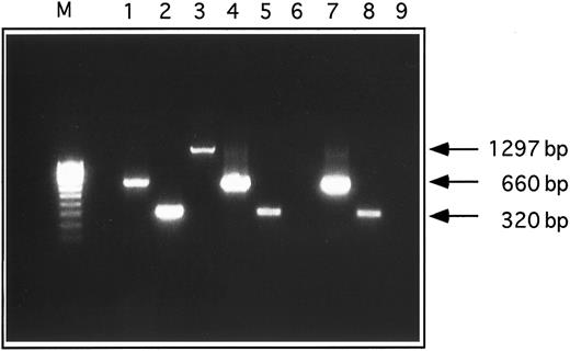 Fig. 2. RT-PCR analysis for PSGL-1 and CD24 expression. cDNAs derived from HL-60, KS and SW2 cells were amplified with sequence-specific oligonucleotide primers specific for PSGL-1 or CD24. For internal control β-actin specific primers were used. The size of the expected bands for each product are indicated. Lane 1, HL-60 cells β-actin primer; lane 2, HL-60 cells CD24 primer; lane 3, HL-60 cells PSGL-1 primer; lane 4, KS cells β-actin primer; lane 5, KS cells CD24 primer; lane 6, KS cells PSGL-1 primer; lane 7, SW2 cells β-actin primer; lane 8, SW2 cells CD24 primer; lane 9, SW2 cells PSGL-1 primer.