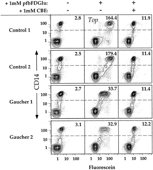 Fig. 4. Discrimination between CD14+ cells isolated from controls or Gaucher patients. PBMC were isolated from two controls and two unrelated Gaucher patients, incubated for 30 minutes in the presence of 1 mmol/L PFBFDGlu, and stained with αCD14 MoAb. Preincubation in the presence of the specific inhibitor CBE was conducted for 1 hour, as described. Dead cells were excluded by software gating on the basis of PI staining. Greater than 90% of cells were viable in all samples analyzed. Ten percent probability contour plots of CD14 versus fluorescein are shown for PBMC incubated in the presence or absence of substrate. The MF values of the CD14+ populations within each sample are displayed in the upper right corner of each plot.