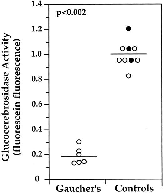 Fig. 5. Summary of normalized median fluorescence (MF ) values of monocytes (CD14+) isolated from Gaucher patients or normal controls. PBMC obtained in four separate experiments from six unrelated patients and seven controls were collected, processed, and analyzed by FACS as described in Fig 4. CBE inhibition was carried out in parallel to determine the GC specific contribution for each sample. The normalized median fluorescein fluorescence values of monocytes are shown for all samples. Three of the control samples (•) were collected from a single individual on 3 different days. To compare analyses conducted on separate days. The CBE correction was conducted, and the mean of the resulting “GC specific” value of the control samples was determined. The activities of all samples were normalized by dividing by this value. The standard deviation of normalized control MF values was ±10%. The mean corrected fluorescein fluorescence of Gaucher patient samples was 19% (SD ± 7% of that determined for control samples (P < .002). Statistical analysis was conducted with JMP software using the Mann-Whitney U test.