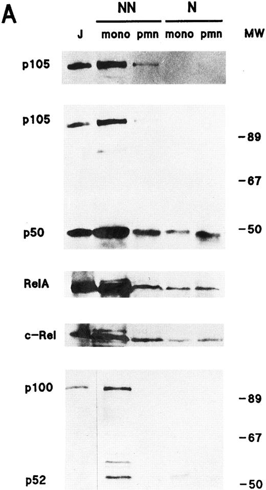 Fig. 1. Cellular distribution of NF-κB/Rel proteins in peripheral blood neutrophils and monocytes. (A) Unstimulated neutrophils or monocyte-enriched mononuclear cell suspensions from the same donor were submitted to NP40 lysis, and the resulting nuclear-containing and nonnuclear fractions were processed for electrophoresis on 15% Kornberg gels (using 106 cell-equivalents per well, unless otherwise stated) and immunoblotting, as described in Materials and Methods. For p105 and p50, the immunoblot was performed using the no. 1157 anti-p50 antiserum; to allow a better visualization of the p105 band in neutrophil nonnuclear fractions, a longer exposure of the same film is shown in the top panel. For p65/RelA, the immunoblot was performed using an antiserum to the N-terminal region (no. 1207). For c-Rel, 6 × 105 cell-equivalents per well were loaded on the gel and immunoblots were performed using the no. 265 antiserum. As a positive migration control for NF-κB/Rel proteins, a whole-cell sample from unstimulated Jurkat T cells was loaded on the outermost left track (“J”). This experiment is representative of at least three. (B) Immunoblots were performed on the same samples as the ones depicted in (A). Upper panel, 106 cell-equivalents were loaded on a 15% Kornberg gel and the membrane was immunoblotted using an anti-LTA4 hydrolase antiserum (“LTAH”). Lower panel, 5 × 105 cell-equivalents were loaded on an 18% Kornberg gel and the membrane was immunoblotted using an anti-FLAP antiserum. This experiment is representative of at least three. N, nuclear fractions; NN, nonnuclear fractions; pmn, polymorphonuclear neutrophils; mono, autologous monocyte-enriched suspensions; MW, molecular weight markers (in kD).
