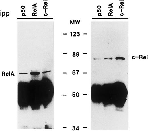 Fig. 2. Characterization of the NF-κB/Rel protein heterodimers present in nonnuclear fractions of resting human neutrophils. Following NP40 lysis of neutrophils, nonnuclear fractions were immunoprecipitated using antisera to individual NF-κB/Rel proteins, and immunoprecipitates (2.5 × 106 cell-equivalents) were analyzed by immunoblot using an antiserum to the N-terminal region of p65/RelA (no. 1207, left panel), or an antiserum to c-Rel (no. 265, right panel). This experiment is representative of at least three. MW, molecular weight markers (in kD); ipp, antiserum used for immunoprecipitation.