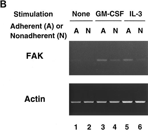 Fig. 1. RT-PCR analysis of lineage-sorted (A) and cytokine-treated (B) murine BM cells. (A) Bone marrow cells from C57BL/6 mice were sorted for RT-PCR to detect FAK mRNA (upper panel) and β-actin mRNA (lower panel). The MoAbs used in sorting were anti-c-Kit (lane 1), Gr-1 (lane 2), Mac-1 (lane 3), TER-119 (lane 4), CD4 (lane 5), CD8 (lane 6), and B220 (lane 7). (B) Day 7 GM-treated cells (lane 3, adherent cells; lane 4, nonadherent cells) and IL-3–treated cells (lane 5, adherent cells; lane 6, nonadherent cells) were subjected to RT-PCR to detect FAK mRNA (upper panel) and β-actin mRNA (lower panel). Unstimulated controls were also analyzed (lane 1, adherent cells; lane 2, nonadherent cells).