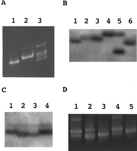 Fig. 2. Hetero-duplex and SSCP analyses. (A) Hetero-duplex analysis of a region spanning exons 4 and 5. Lane 1, TK-4+; lane 2, TK-14−; lane 3, a mixture of TK-4+ and TK-14−. (B) SSCP analysis of exon 5 in marrow hematopoietic progenitor cells. Lane 1, TK-4+; lane 2, TK14− (mutation 1); lane 3, a CD59− CFU-mix; lane 4, a CD59− BFU-E; lane 5, another CD59− BFU-E; lane 6, a CD59+ BFU-E. (C) SSCP analysis of exon 2 in marrow hematopoietic progenitor cells. Lane 1, TK-4+; lane 2, TK-1− (mutation 2); lane 3, a CD59− BFU-E; lane 4, a CD59+ BFU-E. (D) Hetero-duplex analysis of a region spanning exons 4 and 5 in the PB granulocytes. Lanes 1 through 3, mixtures of TK-4+ and three clones from granulocytes; lane 4, a mixture of TK-4+ and TK-14−; lane 5, TK-4+.