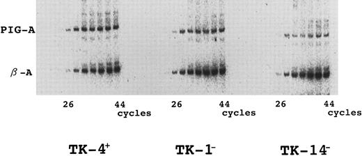 Fig. 6. Quantitative abnormalities of PIG-A transcripts in TK-1− and TK-14−. RNA was reverse transcribed with random primers and PIG-A and β-actin mRNA were amplified by PCR. During PCR, radiolabeled amplification products were removed after every three cycles, separated by electrophoresis in polyacrylamide gel, and visualized by autoradiography. The bands corresponding to PIG-A and β-actin are indicated. Left panel, TK-4+; center panel, TK-1−; right panel, TK-14−.