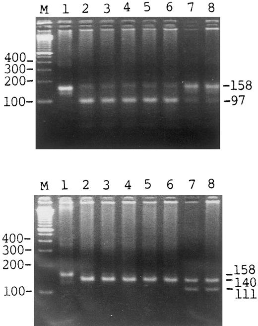 Fig. 1. Detection of the HLA-H Cys 282 Tyr mutation by the presence or absence of specific PCR products. The top panel shows the results of the gel pattern digested by Bcg I; the bottom panel was digested by Rsa I. Lane 1 is the uncut control, lanes 2 to 6 are cases of known hemochromatosis, lane 7 is 1 of the 221 β-thalassemia minor cases, lane 8 is 1 of the 280 cases of the general population. M represents the marker.