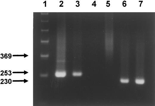 Fig. 3. RT-PCR of sorted CD14+ and CD3+ CB cells. Five hundred sorted cells from each subset were processed for RT-PCR as described in Materials and Methods. The cDNA from each subset was aliquoted and amplified by PCR in separate reactions using primers for FLT3 (lanes 3 and 4) and β2-microglobulin (lanes 6 and 7), respectively. Lane 1, molecular-weight marker. Lane 2, FLT3 RT-PCR product from NALM-1 cells (positive control). Lane 3, cDNA corresponding to CD14+ monocytes. Lane 4, CD3+ T cells. Lane 5, FLT3 RT-PCR of K562 cells (negative control). Lanes 6 and 7, RT-PCR of CD14+ and CD3+ cells, respectively, using primers recognizing two different exons of the β2-microglobulin gene.