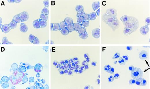 Fig. 5. Differentiation of p19-induced 32D cells. Parental 32D cells (A) and the 2C subclone (B) maintained in medium containing IL-3 but lacking zinc have the appearance of myeloid blast cells. When shifted to medium containing 75 μmol/L zinc (C, D) and examined 4 days later, the cells acquired a macrophage-like morphology (C) and a fraction of them exhibited Fc-receptor-dependent immunophagocytosis (D). When transferred to medium containing G-CSF instead of IL-3, p19-inducible clones exhibited nuclear changes typical of neutrophils after only 3 days of culture (E). Under identical conditions in medium containing both G-CSF and zinc, some macrophage-like cells also emerged (arrowheads) (F ). If clone 2C cells were grown in G-CSF plus zinc for 4 days and shifted back to medium containing IL-3 plus zinc, macrophage-like cells but not neutrophils persisted, and by 7 days after medium change, the cultures resembled those illustrated in (C). No macrophage-like cells were ever observed in cultures of parental 32D cells grown in G-CSF plus zinc (negative data not shown).