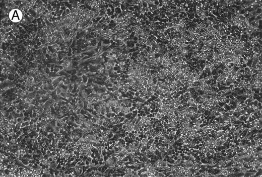 Fig. 2. Micrographs of long-term cultures of B lymphocytes. Micrographs of BM of C/EBPβ+/+ mice (A) and C/EBPβ−/− mice (B) (original magnification × 430). Pictures were taken at 14-week cultures.