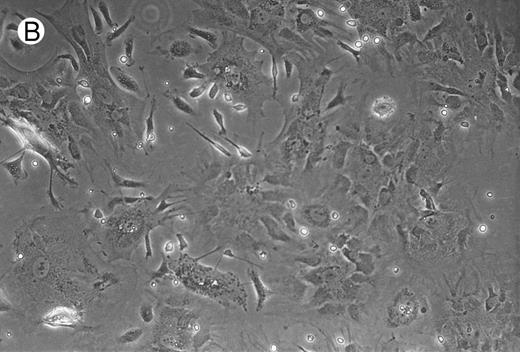 Fig. 2. Micrographs of long-term cultures of B lymphocytes. Micrographs of BM of C/EBPβ+/+ mice (A) and C/EBPβ−/− mice (B) (original magnification × 430). Pictures were taken at 14-week cultures.