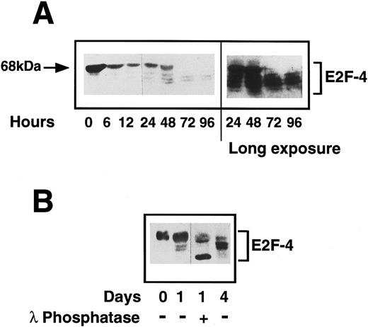 Fig. 7. (A) Expression of E2F-4 in human primary CD34+ hematopoietic cells. Purified CD34+ cells were induced to proliferate by the addition of cytokines as previously described in Materials and Methods. Samples were taken at the times shown and western blotting was performed using a specific anti-E2F–4 antibody. At 0 hours, the 68-kD form of E2F-4 predominates, but as the cells proliferate, the lower forms appear with the complete disappearance of the 68-kD form by 72 hours. A longer exposure of the same blot shows that there is little or no 68-kD form present in the 72- and 96-hour samples. (B) Dephosphorylation of E2F-4 in CD34+ cells by lambda phosphatase. A total of 4 μg of CD34+ whole cell lysate made 1 day after addition of cytokines was incubated for 1 hour with 500 U of lambda phosphatase. This was then added to sample buffer and separated by SDS-PAGE and probed with an anti-E2F–4 antibody. Dephosphorylation of the 68-kD form can be seen by the appearance of a lower, faster running band. Day 0 (quiescent) and day 4 (proliferating) samples are shown for comparison.