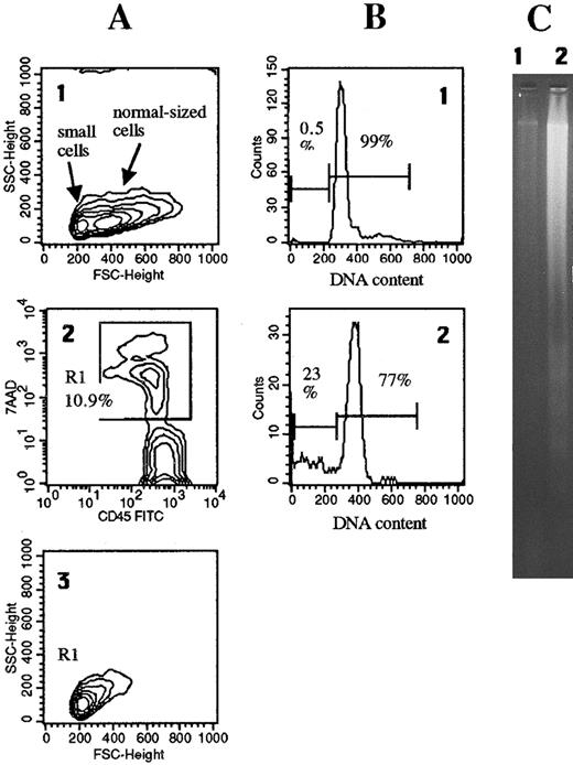 Fig. 1. Dead cells in freshly isolated lymph node cell suspensions lack apoptotic DNA fragmentation and hypodiploidy. A single-cell suspension was obtained from a lymph node (patient #2) by the grinding technique described in Materials and Methods. (A1) Forward scatter (FSC) analysis revealed two distinct cell populations, one composed of abnormally small lymphocytes with a size comparable to that of apoptotic cells,10 and one of normal-sized lymphocytes. (A2) The cell suspension contained 10.9% dead cells, gated in R1, permeable to 7-AAD and stainable with anti-CD45. (A3) Electronic gating on these cells revealed that they corresponded to the population of abnormally small apoptotic-like cells. Only 0.5% of these freshly isolated lymph node cells had an hypodiploid DNA content (B1) and no fragmented DNA was detected by gel electrophoresis (2 × 106 cells) (C1). By contrast, after 24-hour in vitro culture 23% of lymph node cells were hypodiploid (B2) and fragmented DNA could be revealed (C2).