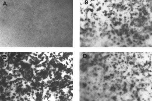 Fig. 1. Detection of a BMSC-secreted PRL-immunoreactive molecule by Elispot assay. Specific PRL spots in unstimulated BMSC (B) are increased after PAF treatment (C) and the effect is abrogated by the PAF-R antagonist WEB 2170 (D). (A) Elispot of PAF-stimulated BMSC in which the anti-PRL antibody has been omitted.