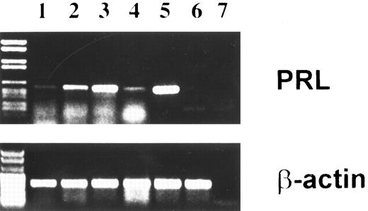 Fig. 3. PRL transcript in BMSC identified by RT-PCR. Passaged stromal layers were cultured in the absence (lane 1) or presence of PAF for 5 (lane 2) and 20 (lane 3) hours, or PAF plus the PAF-R antagonist WEB 2170 (20 hours) (lane 4). Total cell RNA was reverse transcribed and cDNA was amplified using PRL-specific primers and various amplification cycles as described in Materials and Methods. Lane 7 is the no-template control. The base-pair length was determinated with marker DNA fragments (left). Positive and negative controls for PRL mRNA were IM9-P3 (lane 5) and Hep-G2 (lane 6). β-Actin gene expression was also examined as an internal control to ensure RNA integrity and proper amplification. Data are representative of three experiments.