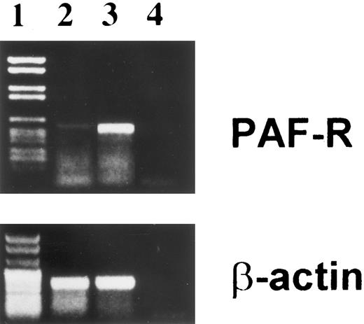 Fig. 5. Expression of PAF-R mRNA by BMSC. PAF-R was detected on BMSC (lane 2) and monocytic cell line U937 as positive control (lane 3), using specific primers and various amplification cycles as described in Materials and Methods. The base-pair length was determined with marker DNA fragments (lane 1). Lane 4 is the no-template control. β-Actin gene expression was also examined as an internal control to ensure RNA integrity and proper amplification.