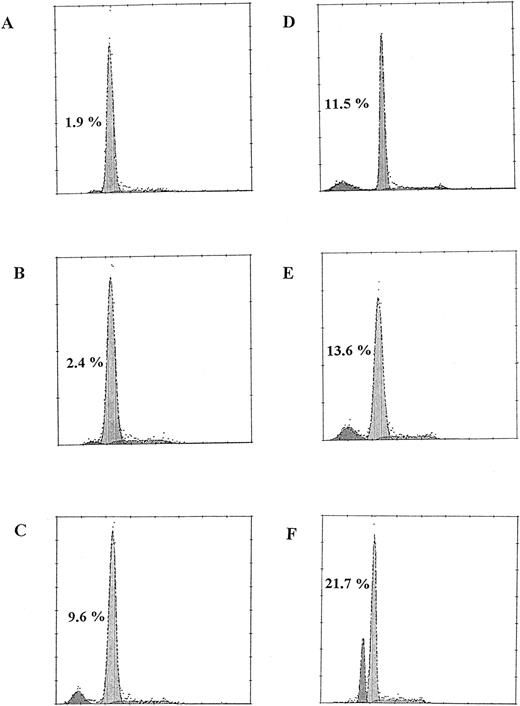 Fig. 3. DNA histograms of human marrow mononuclear cells. Human marrow cells from untreated cultures (A, control) and cultures treated with sin-1, 1 μg/mL (B); sin-1, 100 μg/mL (C); H81.9, 10 μg/mL (D); sin-1, 1 μg/mL + H81.9 (E); and sin-1, 100 μg/mL + H81.9 (F ) were obtained after a 16-hour incubation, stained with PI and analyzed using flow cytometry. Relative numbers of nuclei are shown on the vertical axis and DNA content on the horizontal axis. Apoptotic nuclei are represented by the sub-G1 peak marked by the percentage. Apoptotic features were confirmed by electron microscopy.22 Results of one of four similar experiments are shown.
